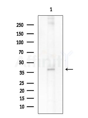 FGFP1 Antibody - Western blot analysis of extracts from HUVEC cells, using FGFP1 Antibody at 1/1000 dilution.
