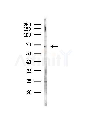 GBP2 Antibody - Western blot analysis of lysates from EC304 cells(heat-shock,45min treatment), using GBP2 Antibody at 1/1000 dilution.