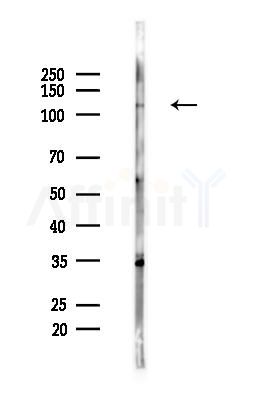 GRIP1 Antibody - Western blot analysis of lysates from Hela cells(heat-shock,45min treatment), using GRIP1 Antibody at 1/1000 dilution.