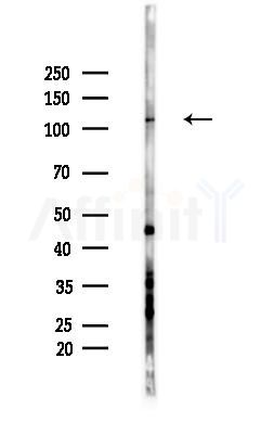 GRIP1 Antibody - Western blot analysis of lysates from LoVo cells(heat-shock,45min treatment), using GRIP1 Antibody at 1/1000 dilution.