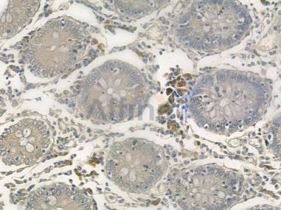 HSPB9 Antibody - DF2507 at 1/100 staining human normal colon tissue by IHC-P.