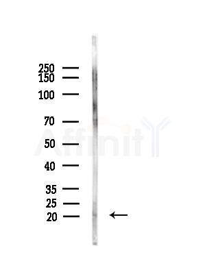 Interferon alpha 2 Antibody - Western blot analysis of lysates from Rat brain, using Interferon alpha 2 Antibody at 1/1000 dilution.