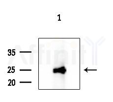 IL1F5 Antibody - Western blot analysis of extracts from COLO205 cells, using IL1F5 Antibody at 1/1000 dilution.