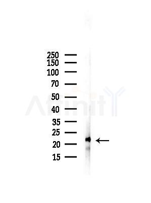 IL1F5 Antibody - Western blot analysis of lysates from COLO205 cells, using IL1F5 Antibody at 1/1000 dilution.