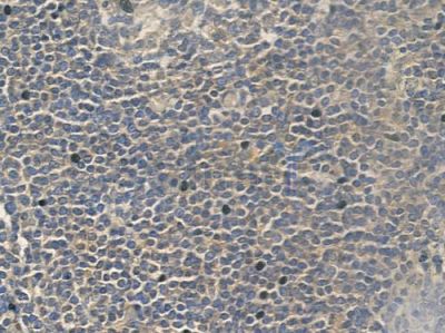 IL1F6 Antibody - DF2524 at 1/100 staining human normal tonsil tissue by IHC-P.