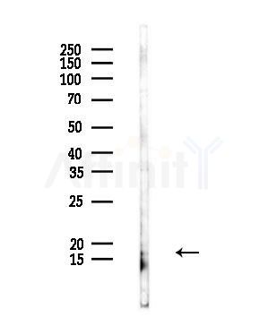 IL1F8 Antibody - Western blot analysis of lysates from Rat liver, using IL1F8 Antibody at 1/1000 dilution.