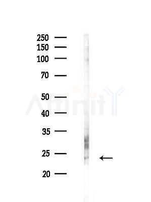 Interleukin 20 Antibody - Western blot analysis of lysates from EC304 cells(heat-shock treatment), using Interleukin 20 Antibody at 1/1000 dilution.