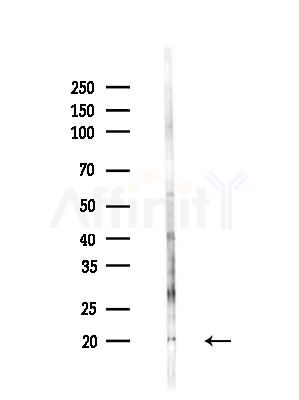 Interleukin 20 Antibody - Western blot analysis of lysates from B16F10-LUC cells(LPS,4h treatment), using Interleukin 20 Antibody at 1/1000 dilution.