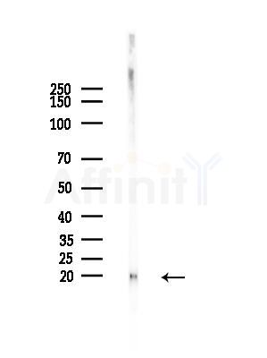IL25 Antibody - Western blot analysis of lysates from Rat brain, using IL25 Antibody at 1/1000 dilution.