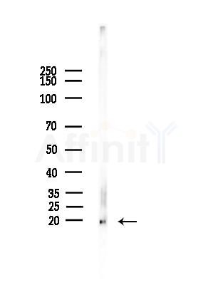 IL25 Antibody - Western blot analysis of lysates from Mouse testis, using IL25 Antibody at 1/1000 dilution.