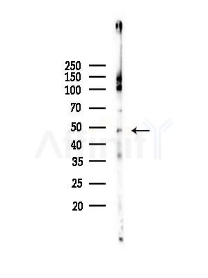 IL5RA Antibody - Western blot analysis of lysates from Mouse lung, using IL5RA Antibody at 1/1000 dilution.