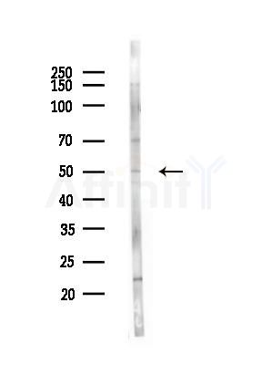 IL6R Antibody - Western blot analysis of lysates from A375 cells(starvation,24h treatment), using IL6R Antibody at 1/1000 dilution.