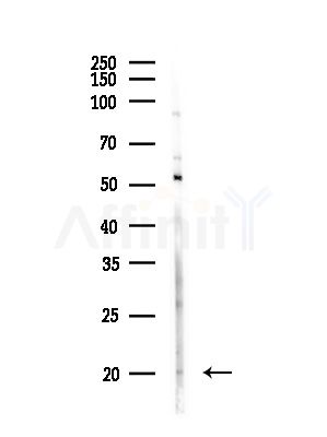 IL9 Antibody - Western blot analysis of lysates from Raji cells(heat-shock,45min treatment), using IL9 Antibody at 1/1000 dilution.