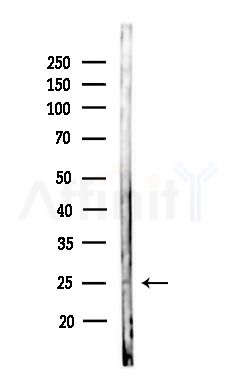 INSL6 Antibody - Western blot analysis of lysates from Hela cells(heat-shock,45min treatment), using INSL6 Antibody at 1/1000 dilution.