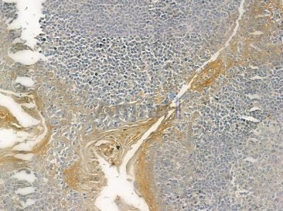 KRT36 Antibody - DF2552 at 1/100 staining human normal tonsil tissue by IHC-P.