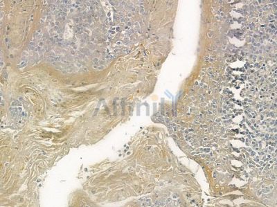 KRT36 Antibody - DF2552 at 1/100 staining human normal tonsil tissue by IHC-P.