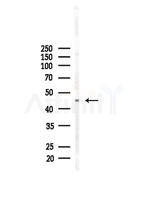 KRT31/33A/33B Antibody - Western blot analysis of lysates from Mouse brain, using KRT31/33A/33B Antibody at 1/1000 dilution.