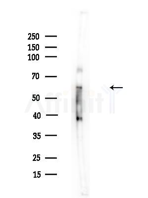 K2C1 Antibody - Western blot analysis of lysates from Mouse brain, using K2C1 Antibody at 1/1000 dilution.