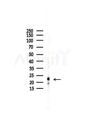 PDCD5 Antibody - Western blot analysis of lysates from COLO205 cells, using PDCD5 Antibody at 1/1000 dilution.