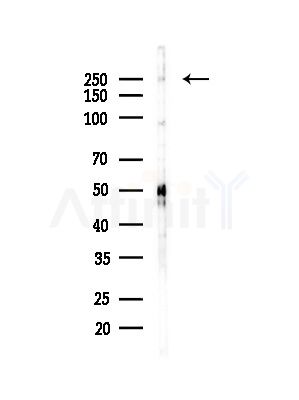PLCE1 Antibody - Western blot analysis of lysates from HepG2 cells(LPS,4h treatment), using PLCE1 Antibody at 1/1000 dilution.