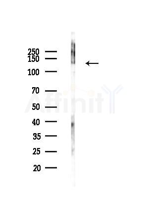 SAP130 Antibody - Western blot analysis of lysates from COLO205 cells(UV,30min treatment), using SAP130 Antibody at 1/1000 dilution.