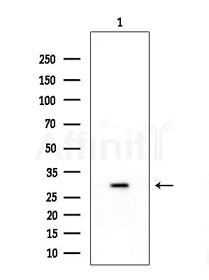 TINP1 Antibody - Western blot analysis of extracts from EC304 cells, using TINP1 Antibody at 1/1000 dilution.