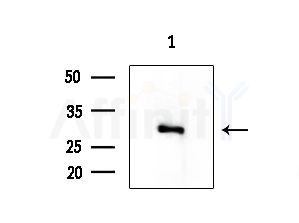 TINP1 Antibody - Western blot analysis of extracts from COLO205 cells, using TINP1 Antibody at 1/1000 dilution.