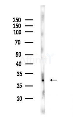 TINP1 Antibody - Western blot analysis of lysates from COLO205 cells, using TINP1 Antibody at 1/1000 dilution.
