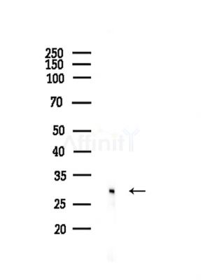 TINP1 Antibody - Western blot analysis of lysates from EC304 cells, using TINP1 Antibody at 1/1000 dilution.