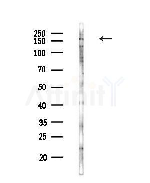 SYCP2 Antibody - Western blot analysis of lysates from COLO205 cells(heat-shock,45min treatment), using SYCP2 Antibody at 1/1000 dilution.