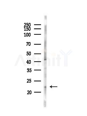 NKIRAS2 Antibody - Western blot analysis of lysates from Mouse testis, using NKIRAS2 Antibody at 1/1000 dilution.