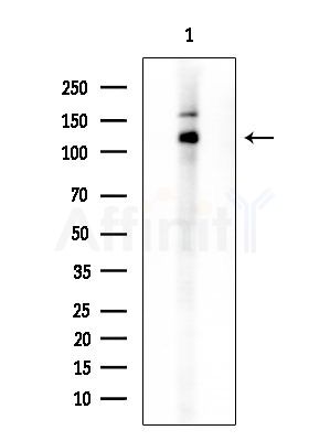 MIB2 Antibody - Western blot analysis of extracts from HepG2 cells(lps 4h treatment), using MIB2 Antibody at 1/1000 dilution.