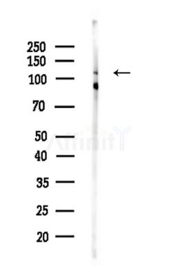 MIB2 Antibody - Western blot analysis of lysates from HepG2 cells(LPS,4h treatment), using MIB2 Antibody at 1/1000 dilution.