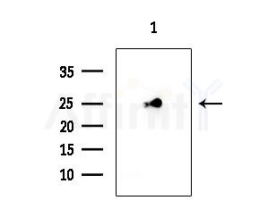 BCL7C Antibody - Western blot analysis of extracts from HepG2 cells(lps 4h treatment), using BCL7C Antibody at 1/1000 dilution.