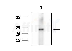 BCL7C Antibody - Western blot analysis of extracts from Hela cells, using BCL7C Antibody at 1/1000 dilution.