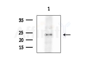 BCL7C Antibody - Western blot analysis of extracts from Mouse liver, using BCL7C Antibody at 1/1000 dilution.