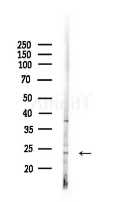 BCL7C Antibody - Western blot analysis of lysates from Mouse liver, using BCL7C Antibody at 1/1000 dilution.