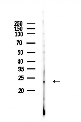 BCL7C Antibody - Western blot analysis of lysates from Hela cells, using BCL7C Antibody at 1/1000 dilution.