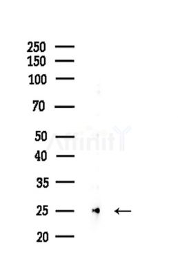 BCL7C Antibody - Western blot analysis of lysates from HepG2 cells(LPS,4h treatment), using BCL7C Antibody at 1/1000 dilution.