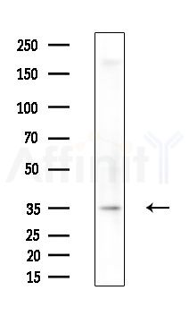 KLF12 Antibody - Western blot analysis of extracts from Hela cells(heat-shock,45min treatment), using KLF12 Antibody at 1/1000 dilution.