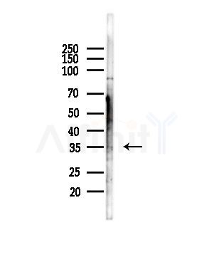 KLF14 Antibody - Western blot analysis of lysates from COLO205 cells(heat-shock,45min treatment), using KLF14 Antibody at 1/1000 dilution.