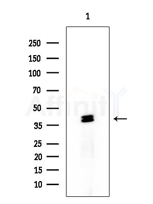 NFE2 Antibody - Western blot analysis of extracts from COLO205 cells, using NFE2 Antibody at 1/1000 dilution.
