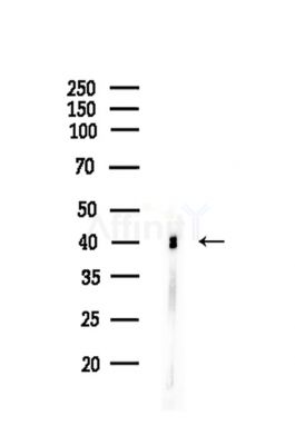 NFE2 Antibody - Western blot analysis of lysates from COLO205 cells, using NFE2 Antibody at 1/1000 dilution.