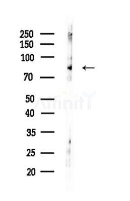 ZBTB16 Antibody - Western blot analysis of lysates from HepG2 cells(LPS,4h treatment), using ZBTB16 Antibody at 1/1000 dilution.