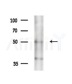 Cytochrome P450 7A1 Antibody - Western blot analysis of extracts from Rat brain, using Cytochrome P450 7A1 Antibody at 1/1000 dilution.