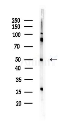 C9orf156 Antibody - Western blot analysis of lysates from HepG2 cells(LPS,4h treatment), using C9orf156 Antibody at 1/1000 dilution.