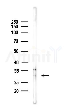 ING2 Antibody - Western blot analysis of lysates from Hela cells(LPS,4h treatment), using ING2 Antibody at 1/1000 dilution.