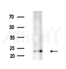 ING4 Antibody - Western blot analysis of extracts from 293 cells(starvation treatment), using ING4 Antibody at 1/1000 dilution.