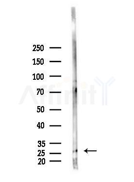 ING4 Antibody - Western blot analysis of lysates from 293 cells(starvation,24h treatment), using ING4 Antibody at 1/1000 dilution.