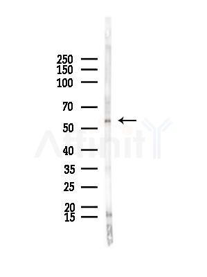 HRB Antibody - Western blot analysis of lysates from B16F10-LUC cells(starvation,24h treatment), using HRB Antibody at 1/1000 dilution.